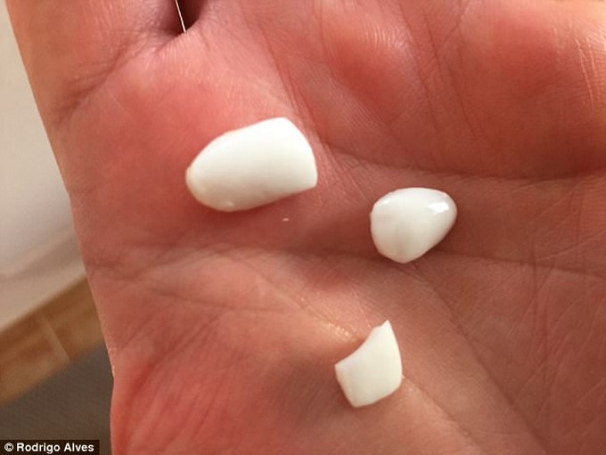 Rodrigo Alves- Ken Humano/ Tomada de MailOnline