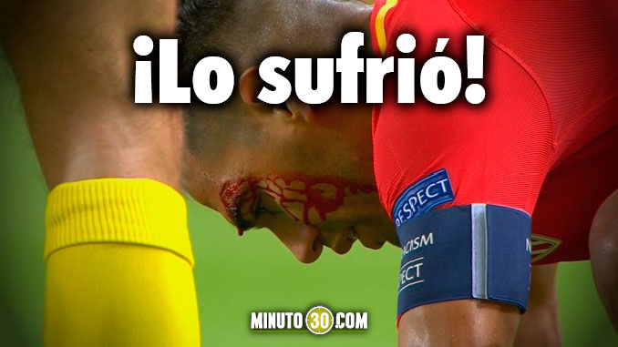 VIDEO: ¡Mala noche! Falcao sucumbió en casa ante el Porto