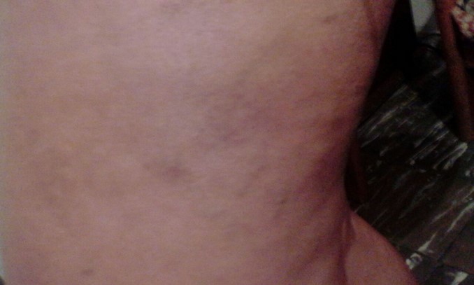 Denuncian aparente abuso de autoridad contra detenido en la estación de Policía Candelaria