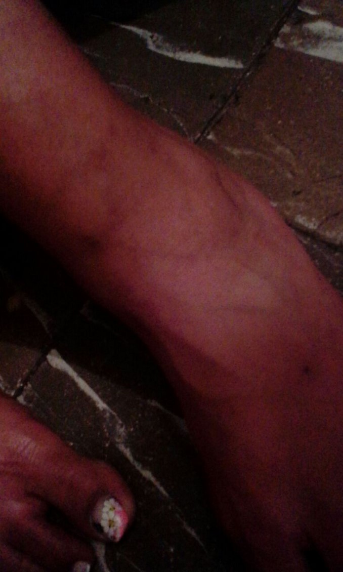 Denuncian aparente abuso de autoridad contra detenido en la estación de Policía Candelaria