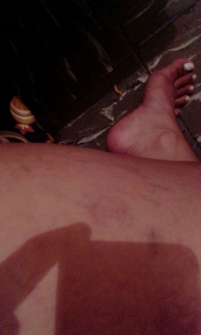 Denuncian aparente abuso de autoridad contra detenido en la estación de Policía Candelaria