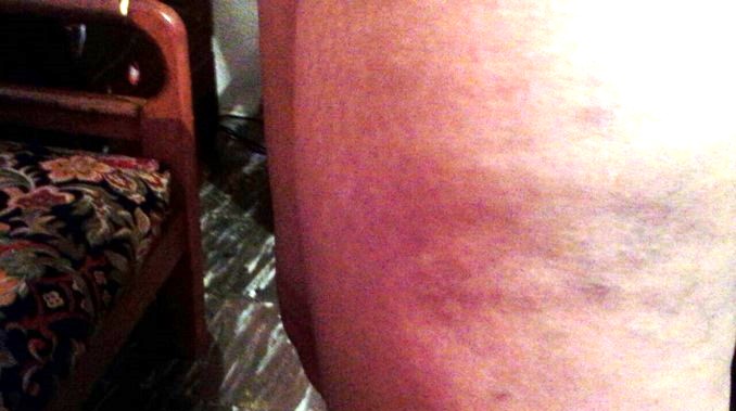 Denuncian aparente abuso de autoridad contra detenido en la estación de Policía Candelaria