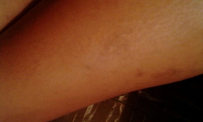 Denuncian aparente abuso de autoridad contra detenido en la estación de Policía Candelaria