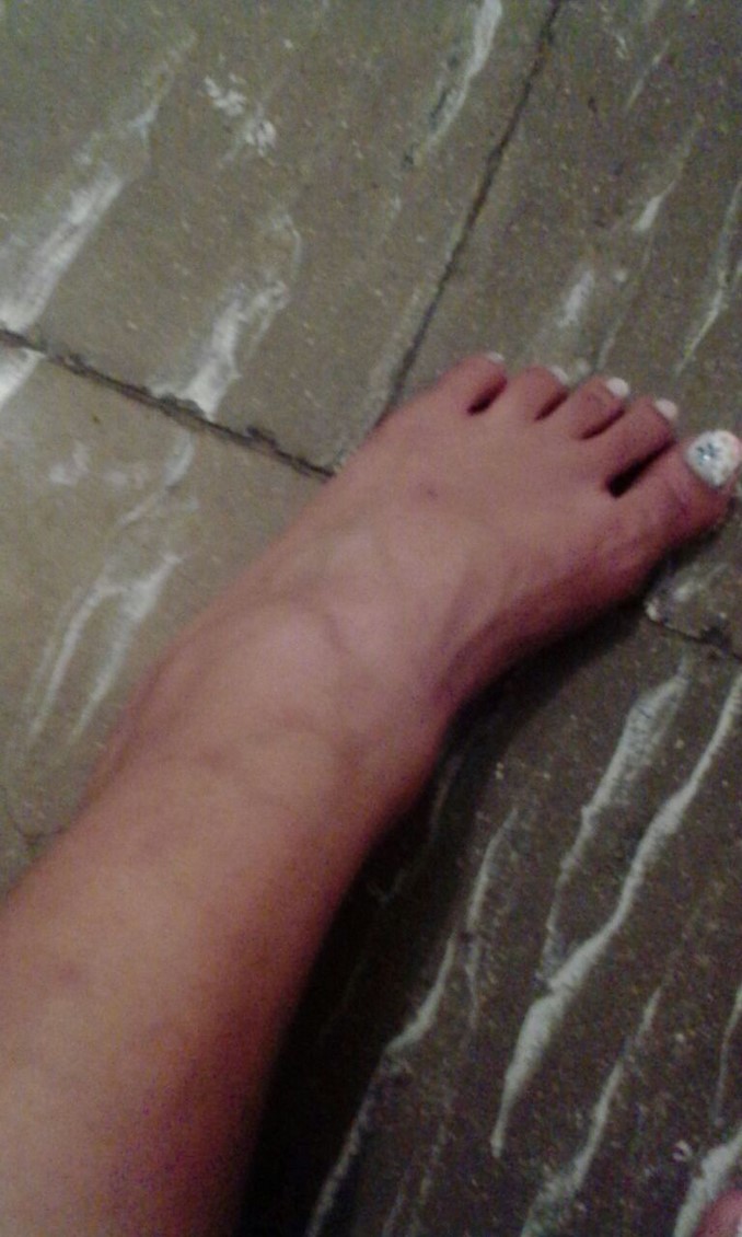 Denuncian aparente abuso de autoridad contra detenido en la estación de Policía Candelaria