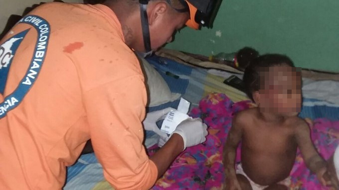 Niña herida casa por fuertes lluvias