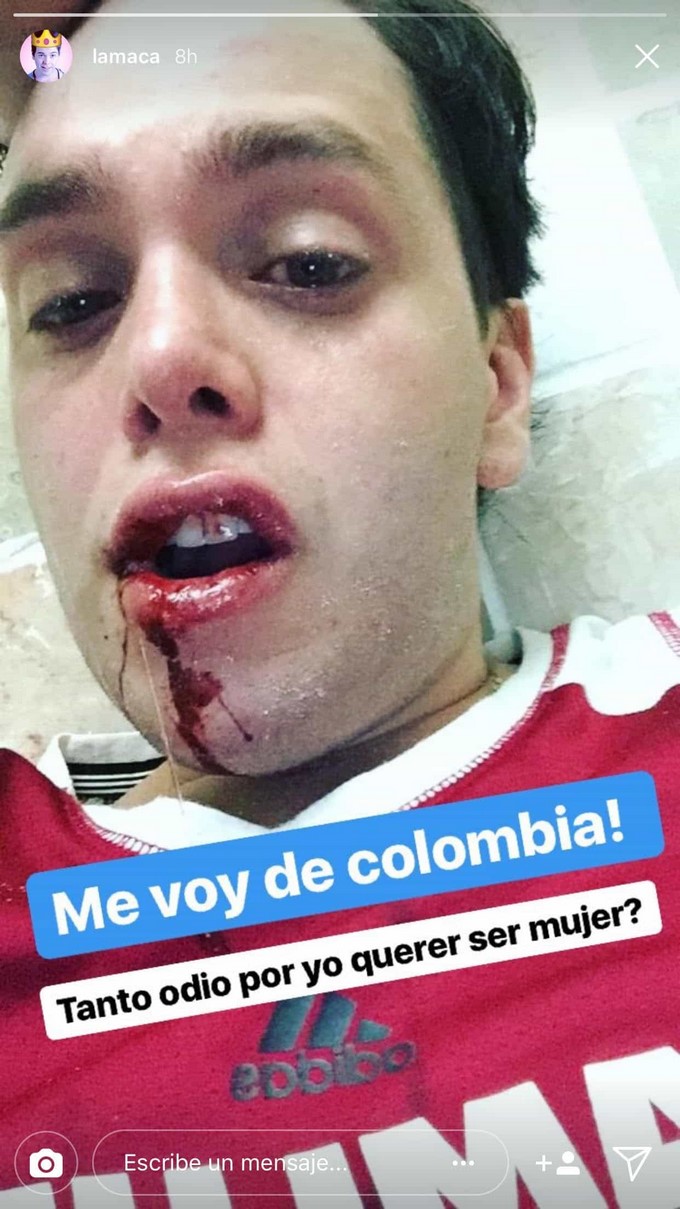 Edward Tremendo/ Captura tomada de Instagram: @lamaca