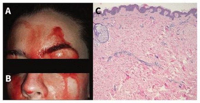 Foto Canadian Medical Association Journal