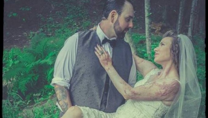 Angel_Fiorini_incendio