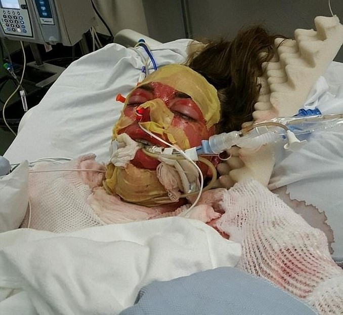 Angel_Fiorini_incendio