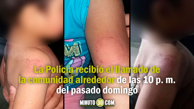 AUDIO: Dos menores resultaron heridos con mordiscos al parecer ocasionados por su propia madre 1 Menores_mordidos