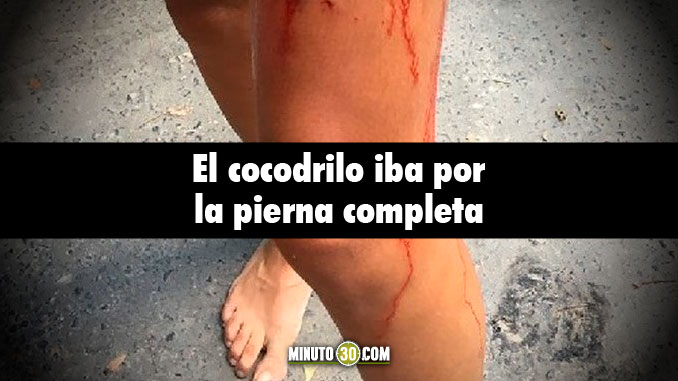 VIDEO: El cocodrilo brincó y le mordió la pierna a una turista