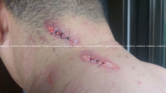 Alcalde_Concepcion_2