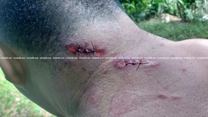 Alcalde_Concepcion_3