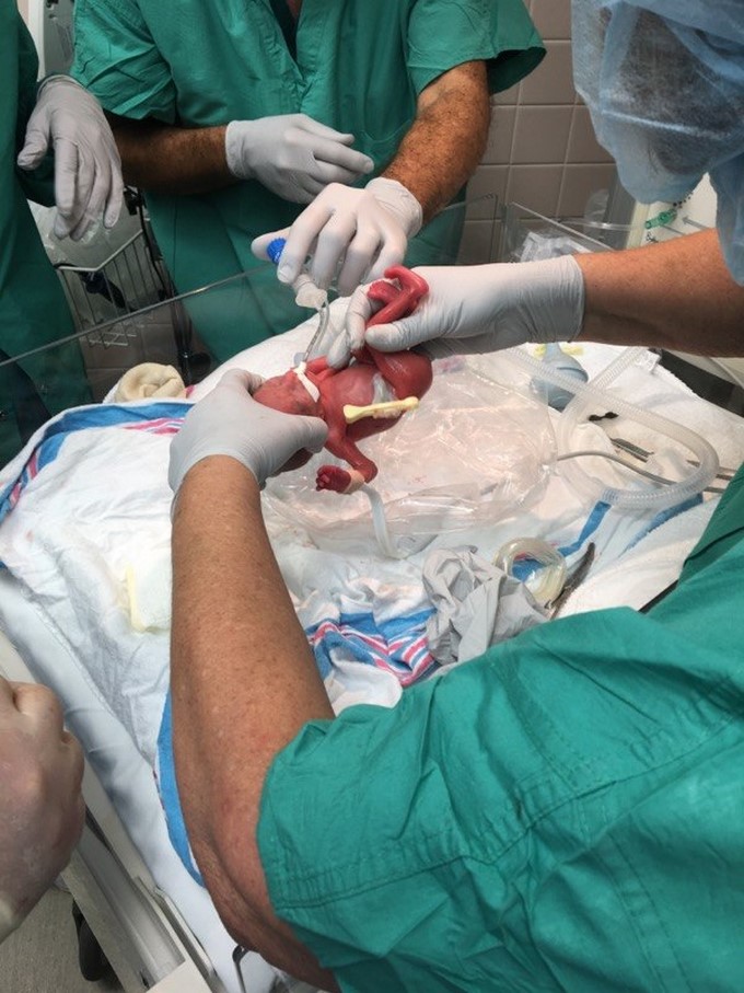 Lailie Victoria, una bebé de casi cuatro meses y medio que pesó al nacer solo 13 onzas (poco más de 368 gramos)/EFE