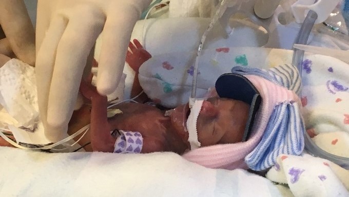 Lailie Victoria, una bebé de casi cuatro meses y medio que pesó al nacer solo 13 onzas (poco más de 368 gramos)/EFE