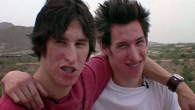 Mike y Matt Schlepp antes de someterse a las cirugías.