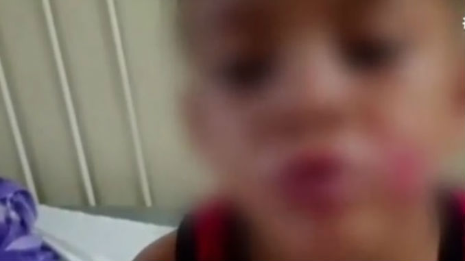 Menor_Quemado