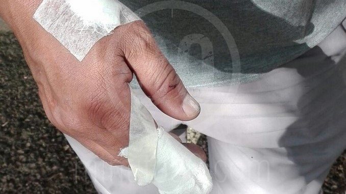 FOTOS: Se aplicó eutanasia a perro Pitbull que atacó a tres personas en La Iguaná 1 ataque perro iguana 1