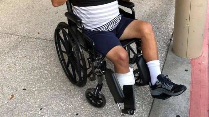 Estaba de vacaciones y en el hospital le curaron una herida con vinagre. Regresó con una pierna amputada