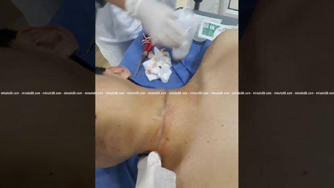 Modalidad de hurto en el Puente de la Madre Laura