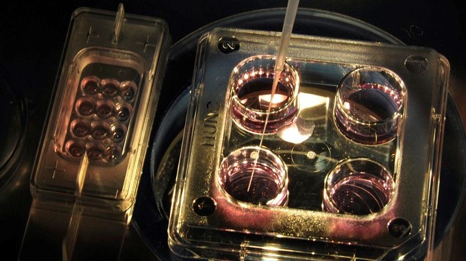 os científicos lograron que el óvulo humano se pudiera desarrollar fuera del ovario, a partir de su fase más temprana hasta llegar a alcanzar la plenitud de su madurez. EFE/Archivo