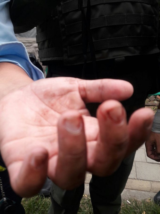 VIDEO Y FOTOS: Hombre agredió a un agente de tránsito en Ciudad del Río 5 Agente de transito agredida por Ciudad del R%C3%ADo 3