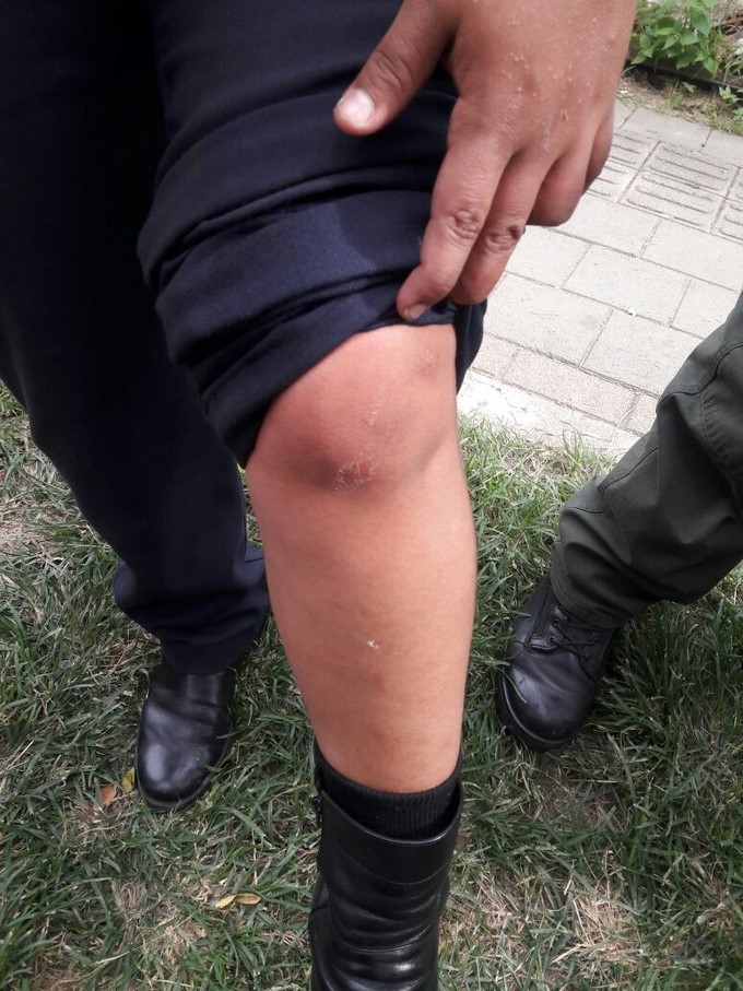 VIDEO Y FOTOS: Hombre agredió a un agente de tránsito en Ciudad del Río 7 Agente de transito agredida por Ciudad del R%C3%ADo 5