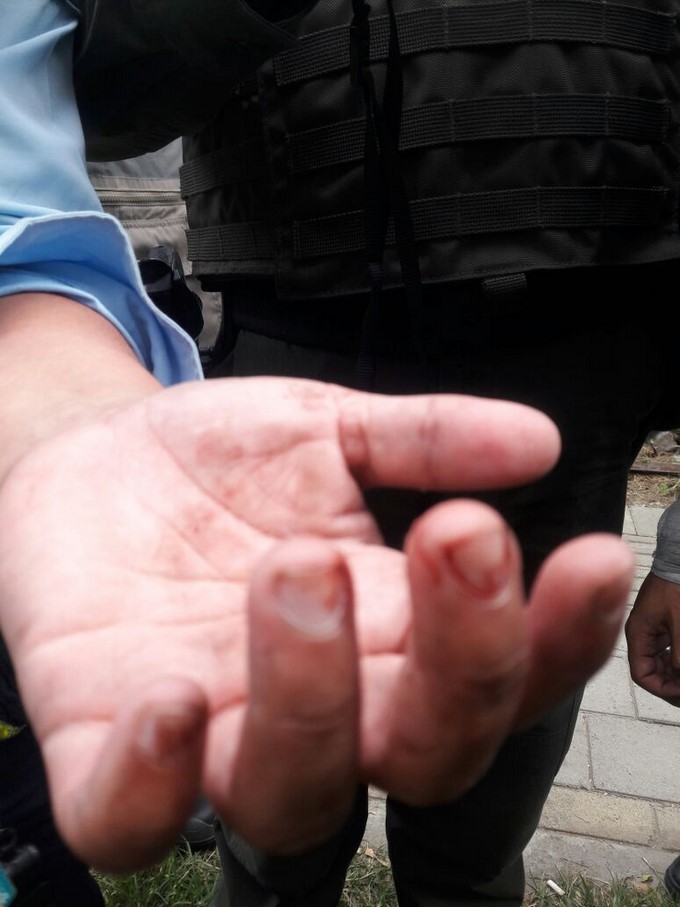 VIDEO Y FOTOS: Hombre agredió a un agente de tránsito en Ciudad del Río 8 Agente de transito agredida por Ciudad del R%C3%ADo 6
