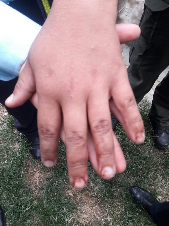 VIDEO Y FOTOS: Hombre agredió a un agente de tránsito en Ciudad del Río 11 Agente de transito agredida por Ciudad del R%C3%ADo 9