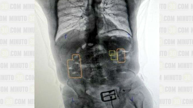 Anciano_Capturado_El_Dorado_2