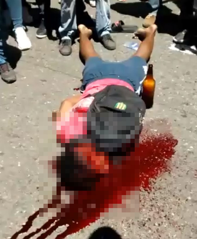 FOTOS: Joven atacado a machete tendría 15 años 4 atacado a machete 2
