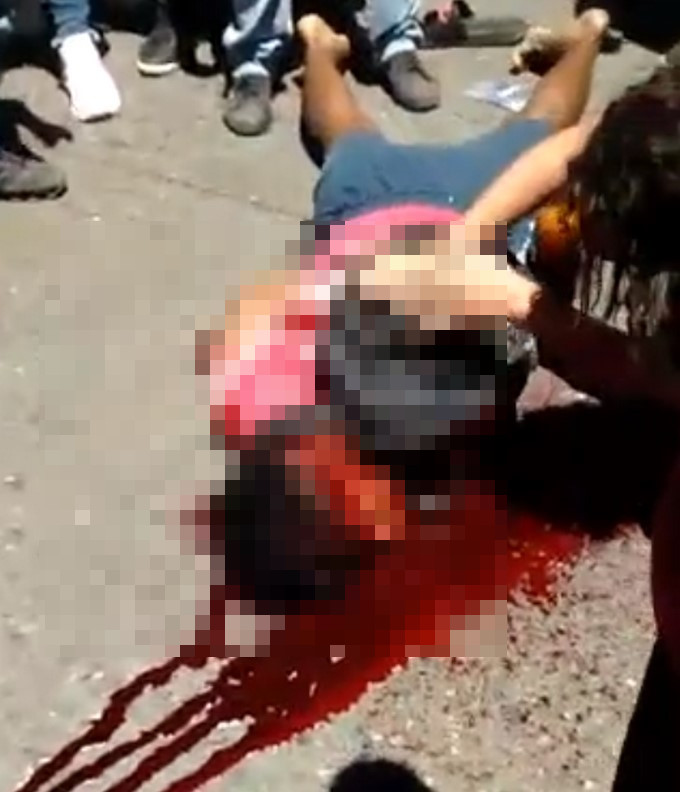 FOTOS: Joven atacado a machete tendría 15 años 3 atacado a machete