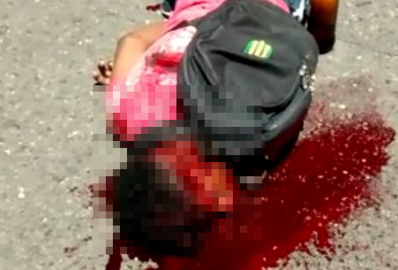 hombre atacado a machete