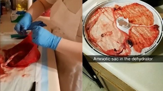 EN FOTOS: Una mujer hizo “chocolaticos” con su placenta y publicó el tutorial paso a paso