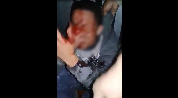 Tremenda golpiza recibió un presunto ladrón en el sector Estadio