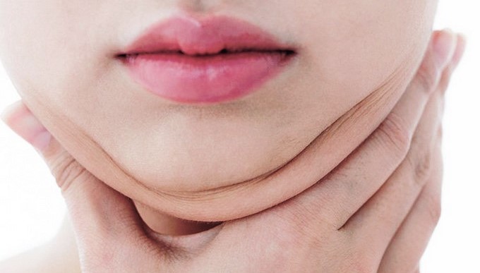 ¿Papada? Elimínala con estos 8 trucos