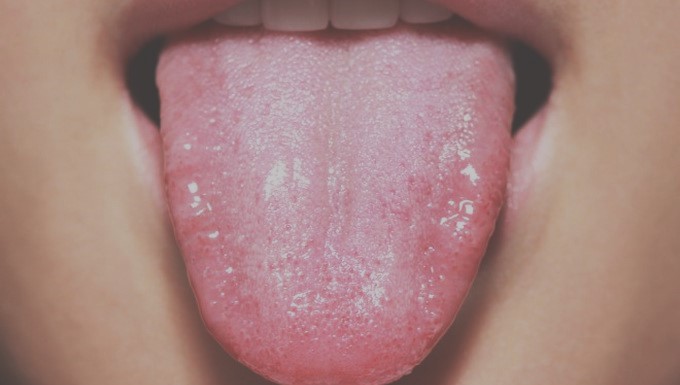 Así es como la lengua revela el estado de tu salud