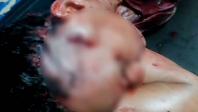 Gloria Jiménez Julio, líder comunitaria agredida por su esposo en Cartagena