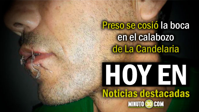 Lo de Hoy en Minuto 30: Hace huelga de hambre con la boca cosida