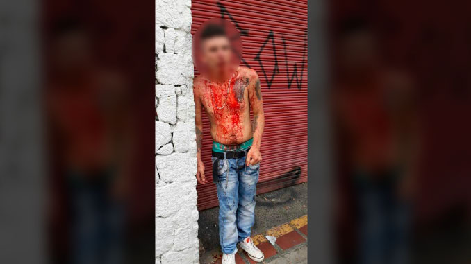 Presunto ladrón golpeado en Juan del Corral