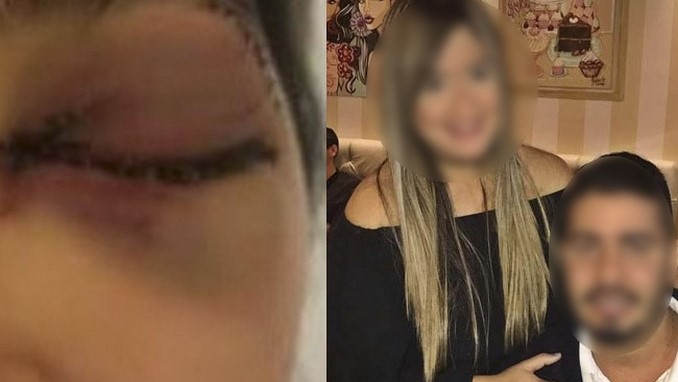 Con un portátil por poco un hombre le saca el ojo a su compañera sentimental. Ocurrió en Atlántico