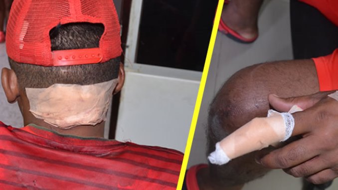 Yeimar Guerra Mendoza, agredido por una mujer