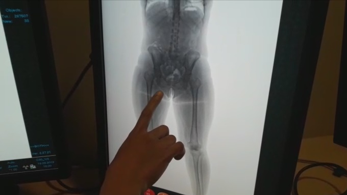 Detienen en ElDorado a pareja que pretendía viajar con cocaína a Madrid