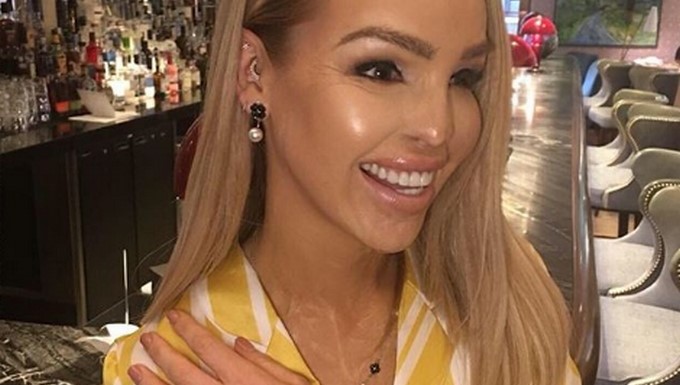 Katie Piper/ Tomada de Instagram: @katiepiper_
