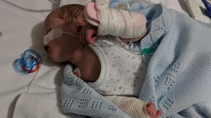 Bebe De 11 Dias En Grave Estado De Salud Por Beso De Un Adulto Con Herpes Minuto30 Com