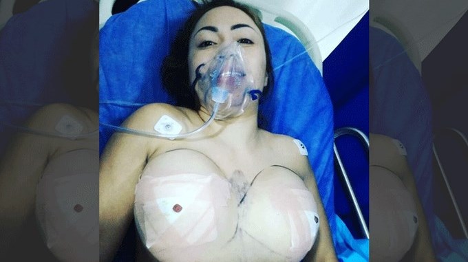 VIDEO: Epa Colombia volverá al quirófano a realizarse una nueva cirugía