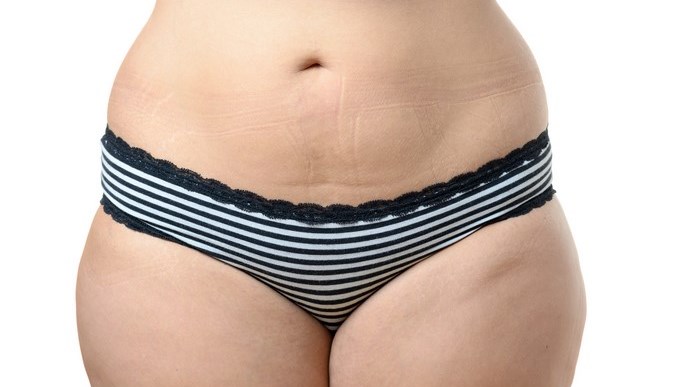 gordita