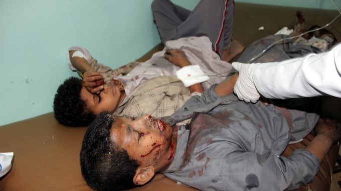 Mortandad de niños menores de 5 a causa del hambre, los estragos de la guerra en Yemen