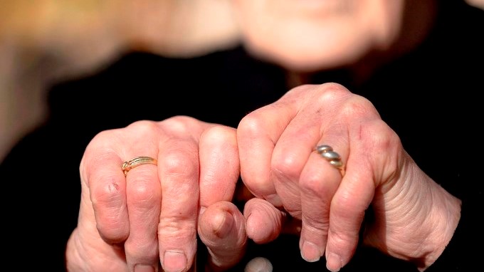 Por celos un hombre de 35 años le propina una golpiza a su pareja de 83 años