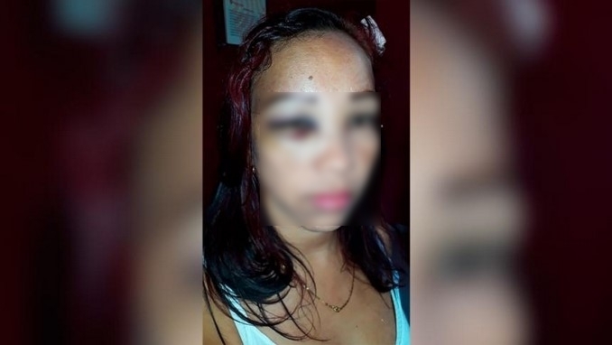 Cindy Anguila, mujer que denunció agresión de policías en Malambo, Atlántico